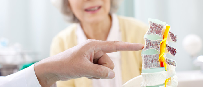 a doctor pointing to a disc on on statue spine